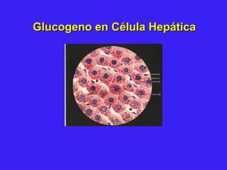 Glucogeno en Célula HepáticaGlucogeno en Célula Hepática
 