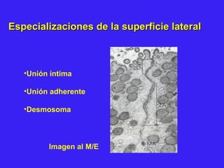 Especializaciones de la superficie lateralEspecializaciones de la superficie lateral
•Unión íntima
•Unión adherente
•Desmosoma
Imagen al M/E
 
