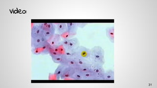 Video:
31
 