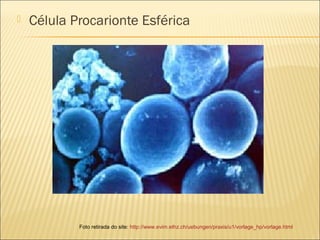  Célula Procarionte Esférica
Foto retirada do site: http://www.evim.ethz.ch/uebungen/praxis/u1/vorlage_hp/vorlage.html
 