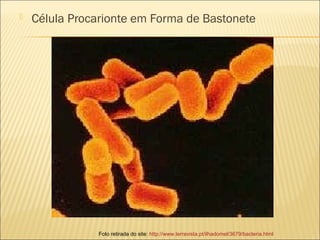  Célula Procarionte em Forma de Bastonete
Foto retirada do site: http://www.terravista.pt/ilhadomel/3679/bacteria.html
 