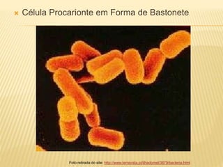  Célula Procarionte em Forma de Bastonete
Foto retirada do site: http://www.terravista.pt/ilhadomel/3679/bacteria.html
 