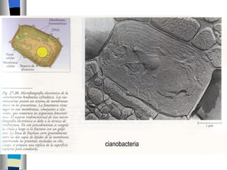 cianobacteria 