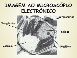 IMAGEM AO MICROSCÓPIO
ELECTRÓNICO
Mitocôndrias
Núcleo
Cloroplastos
Vacúolo Nucléolo
 