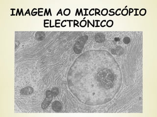 IMAGEM AO MICROSCÓPIO
ELECTRÓNICO
 
