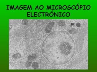 IMAGEM AO MICROSCÓPIO
     ELECTRÓNICO
 