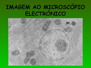 IMAGEM AO MICROSCÓPIO
ELECTRÓNICO
 