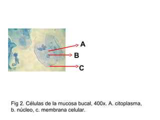 A
B
C
Fig 2. Células de la mucosa bucal, 400x. A. citoplasma,
b. núcleo, c. membrana celular.
 