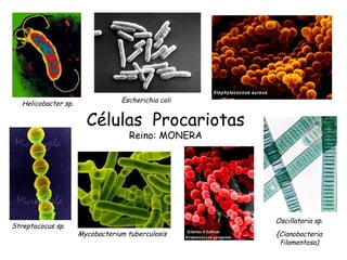 Células Procariotas
Reino: MONERA
Helicobacter sp. Escherichia coli
Streptococus sp.
Mycobacterium tuberculosis
Oscillatoria sp.
(Cianobacteria
filamentosa)
 