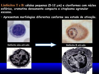 Linfócitos T e B: células pequenas (5–12 µm) e claviformes com núcleo
esférico, cromatina densamente compacta e citoplasma agranular
escasso.
• Apresentam morfologias diferentes conforme seu estado de ativação.
linfócito não-ativado linfócito B ativado
 