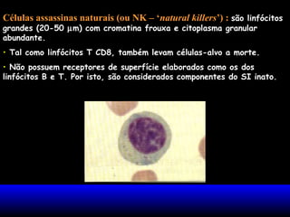 Células assassinas naturais (ou NK – ‘natural killers’) : são linfócitos
grandes (20-50 µm) com cromatina frouxa e citoplasma granular
abundante.
• Tal como linfócitos T CD8, também levam células-alvo a morte.
• Não possuem receptores de superfície elaborados como os dos
linfócitos B e T. Por isto, são considerados componentes do SI inato.
 