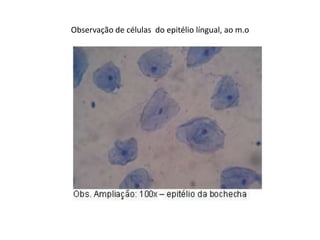 Observação de células do epitélio língual, ao m.o
 