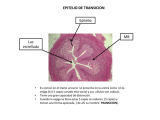 EPITELIO DE TRANSICION


                                           Epitelio



                                                                              MB
   Luz
estrellada




       •     Es común en el tracto urinario se presenta en la uretra como en la
             vejiga (4 o 5 capas cunado esta vacía) y sus células son cubicas.
       •     Tiene una gran capacidad de distención.
       •     Cuando la vejiga se llena estas 5 capas se reducen (3 capas) y
             toman una forma aplanada. ( de ahí su nombre TRANSICION).
 