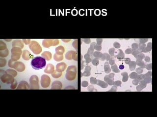 LINFÓCITOS 
