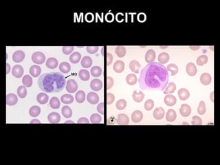 MONÓCITO 