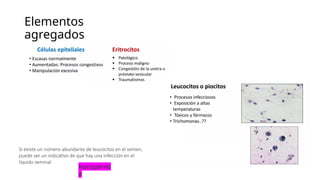 Elementos
agregados
Si existe un número abundante de leucocitos en el semen,
puede ser un indicativo de que hay una infección en el
líquido seminal.
leucospermi
a
 