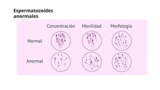 Espermatozoides
anormales
 