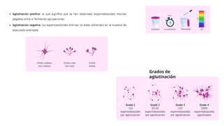 Grados de
aglutinación
 