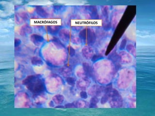 MACRÓFAGOSNEUTRÓFILOS