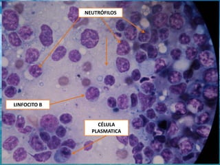NEUTRÓFILOSLINFOCITO BCÉLULA PLASMATICA