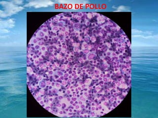 BAZO DE POLLO