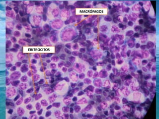 MACRÓFAGOSERITROCITOS