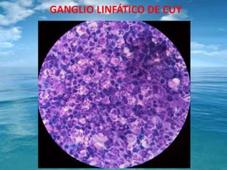 GANGLIO LINFÁTICO DE CUY