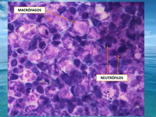 MACRÓFAGOSNEUTRÓFILOS