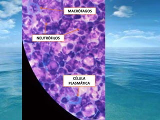 MACRÓFAGOSNEUTRÓFILOSCÉLULAPLASMÁTICA