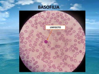 BASOFILIALINFOCITO