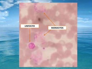 LINFOCITOMONOCITOS