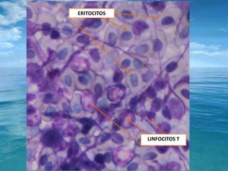 ERITOCITOSLINFOCITOS T