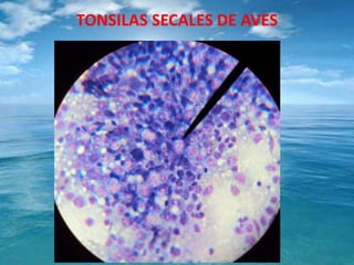 TONSILAS SECALES DE AVES