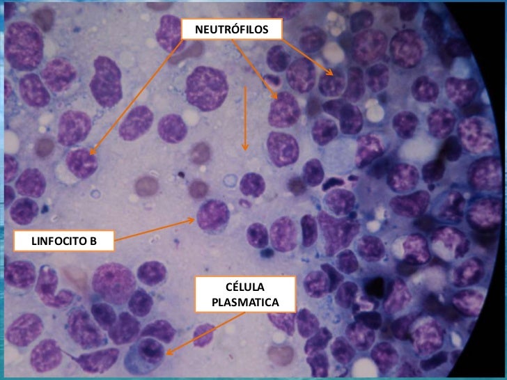 Celulas Linfoideas