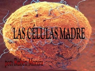 LAS CÉLULAS MADRE por: Rubén Morera 