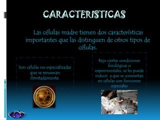 CARACTERISTICAS
     Las células madre tienen dos características
   importantes que las distinguen de otros tipos de
                       células.

                                  Bajo ciertas condiciones
Son células no especializadas           fisiológicas o
      que se renuevan           experimentales, se les puede
                                inducir a que se conviertan
      ilimitadamente.
                                  en células con funciones
                                          especiales
 