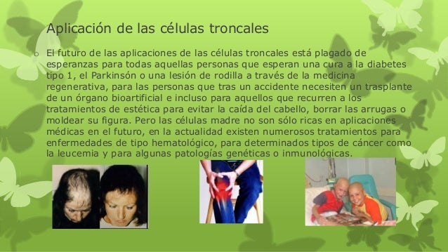 Se tiene cuanto implant en el pecho