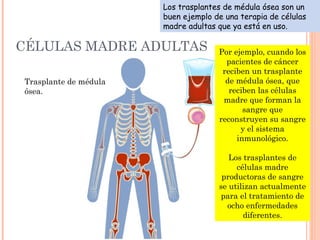 CÉLULAS MADRE ADULTAS
Trasplante de médula
ósea.
Los trasplantes de médula ósea son un
buen ejemplo de una terapia de células
madre adultas que ya está en uso.
Por ejemplo, cuando los
pacientes de cáncer
reciben un trasplante
de médula ósea, que
reciben las células
madre que forman la
sangre que
reconstruyen su sangre
y el sistema
inmunológico.
Los trasplantes de
células madre
productoras de sangre
se utilizan actualmente
para el tratamiento de
ocho enfermedades
diferentes.
 