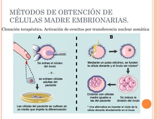 MÉTODOS DE OBTENCIÓN DE
CÉLULAS MADRE EMBRIONARIAS.
Clonación terapéutica. Activación de ovocitos por transferencia nuclear somática
 