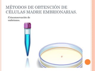 MÉTODOS DE OBTENCIÓN DE
CÉLULAS MADRE EMBRIONARIAS.
Crioconservación de
embriones.
 