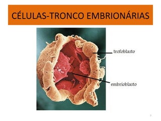 CÉLULAS-TRONCO EMBRIONÁRIAS 