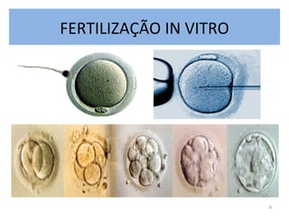 FERTILIZAÇÃO IN VITRO 