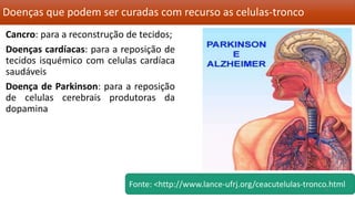 Doenças que podem ser curadas com recurso as celulas-tronco
Cancro: para a reconstrução de tecidos;
Doenças cardíacas: para a reposição de
tecidos isquémico com celulas cardíaca
saudáveis
Doença de Parkinson: para a reposição
de celulas cerebrais produtoras da
dopamina
Fonte: <http://www.lance-ufrj.org/ceacutelulas-tronco.html9
 
