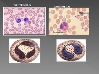 NEUTRÓFILO
EOSINÓFILO
 
