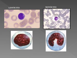 LINFÓCITO MONÓCITO
 