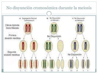 No disyunción cromosómica durante la meiosis
 