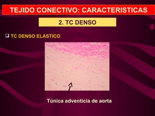 TEJIDO CONECTIVO: CARACTERISTICAS
2. TC DENSO
 TC DENSO ELASTICO
Túnica adventicia de aorta
 