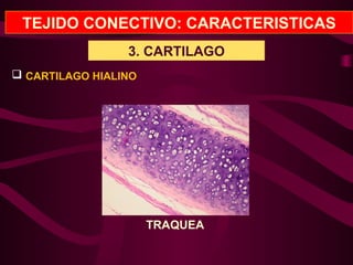TEJIDO CONECTIVO: CARACTERISTICAS
3. CARTILAGO
 CARTILAGO HIALINO
TRAQUEA
 