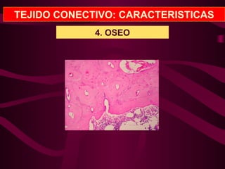 TEJIDO CONECTIVO: CARACTERISTICAS
4. OSEO
 