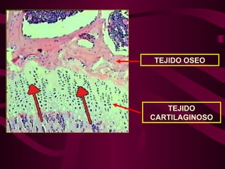 TEJIDO OSEO
TEJIDO
CARTILAGINOSO
 
